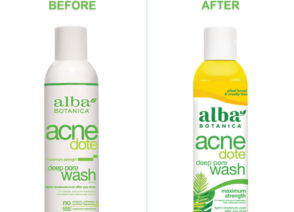 Alba Botanica Acnedote Acnedote  Maximum Strength Deep Clean Astringent 6 Ounce (Pack Of 1)